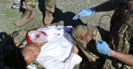 Field dressing applied to Israil's 'injured' shoulder